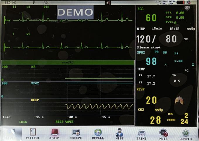 12 inch Built-in Battery Multi Parameter Patient Monitor 1
