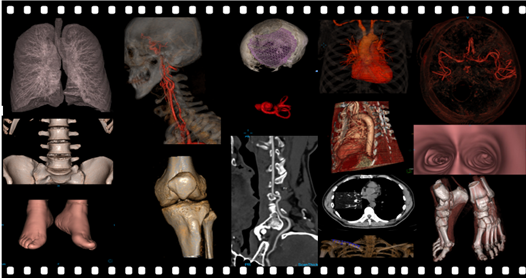 ISO13485 Certified High End 5.3 MHU 76cm Hole 64 Slice Ct Scanner 0