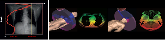 Low End 76cm 5.3MHU 64 Slices Computed Tomography Machine 2