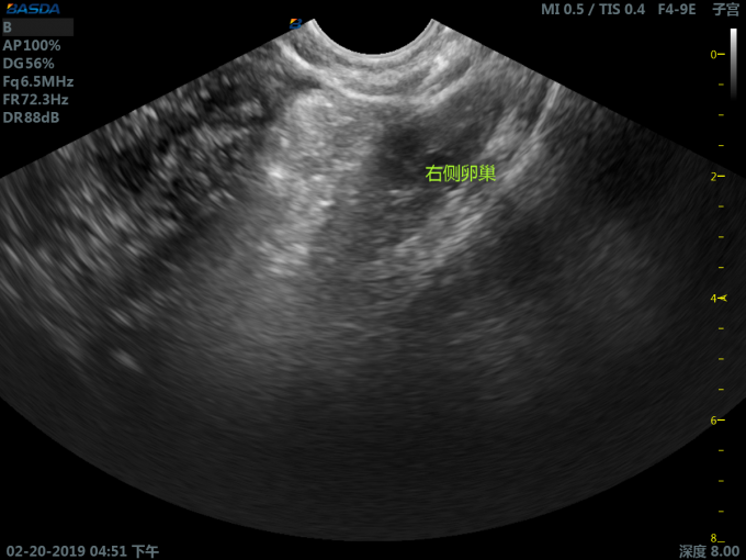 Cartbase 3D Ultrasound Pregnancy 110 Voltage Medical Ultrasound Machine Color UltrasoundBTH-300S 2