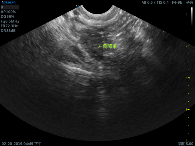 Cartbase 3D Ultrasound Pregnancy 110 Voltage Medical Ultrasound Machine Color UltrasoundBTH-300S 3