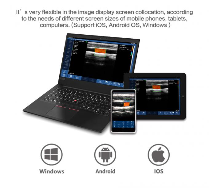 Digital Mobile Handheld Portable Ultrasound Device Linear Wireless Whole Body 0