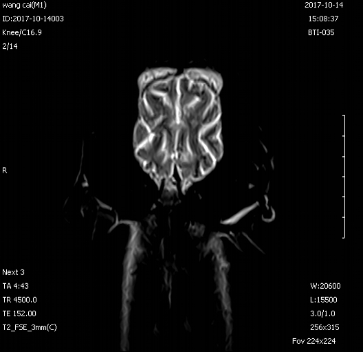C Shape Veterinary Machine , Permanent 0.35 Tesla Veterinary Mri Scanners 1
