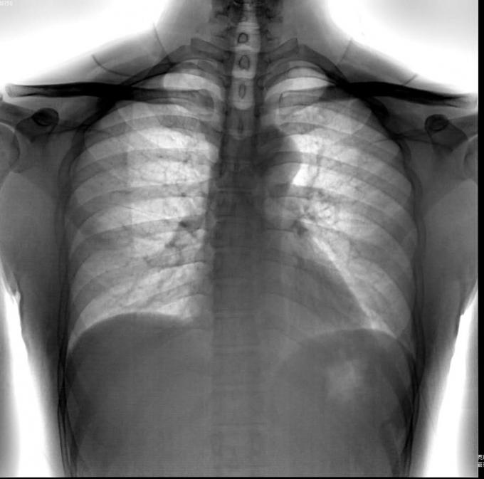 Full Size 65kW FPD Island Table Gastrointestinal Digital X Ray Machine 1