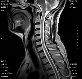 CE 0.3T Cost Effective Open C-Shape Load Permanent Magnet MRI Machine BTI-030 0