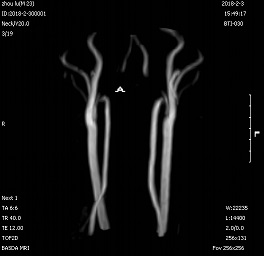CE 0.3T Cost Effective Open C-Shape Load Permanent Magnet MRI Machine BTI-030 1