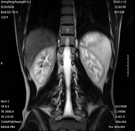 CE 0.3T Cost Effective Open C-Shape Load Permanent Magnet MRI Machine BTI-030 2