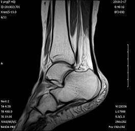 CE Permanent Magnet Cost Effective 0.3 Tesla Open MRI Machine For Medical Imaging BTI-030 2