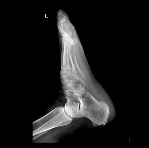 DDR Type 50KW 150KV Ceiling Automatic X Ray Machine BTR-X500 0