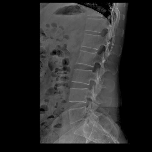 BTR-650B DR system 65kW DDR Digital X-Ray Dual Column DR 3
