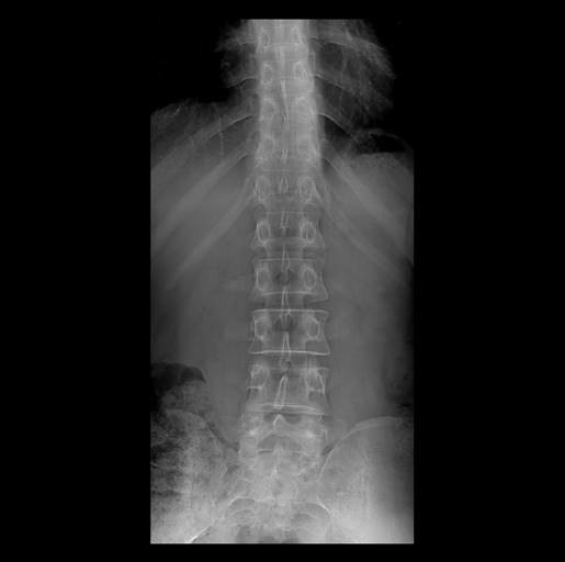 BTM-10 Digital Mammography System high power good image quality 0