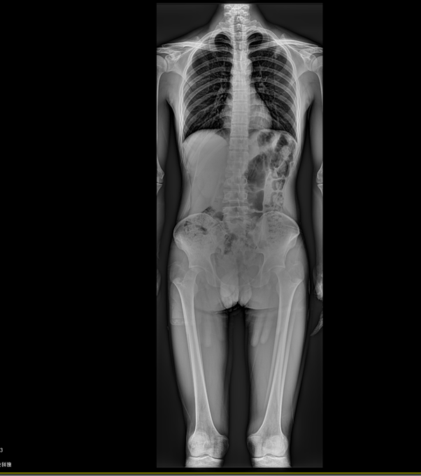 CE Island Table Gastrointestinal Digital X Ray Equipment BTF-650DRF 2