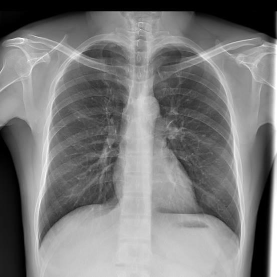 Ceiling Suspended DDR Ceiling Mounted Body X Ray Machine 50kW BTR-X500 0