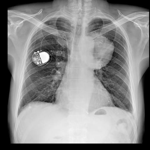 BTR-650B DR System 65kW DDR 1/2 FPD Full Body Floor Mounted 800mA Wired/Wireless Motor 1