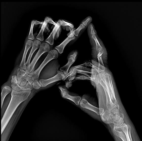 65kW DDR 1/2 FPD 800mA Floor Mounted X Ray Machine  BTR-650B 4