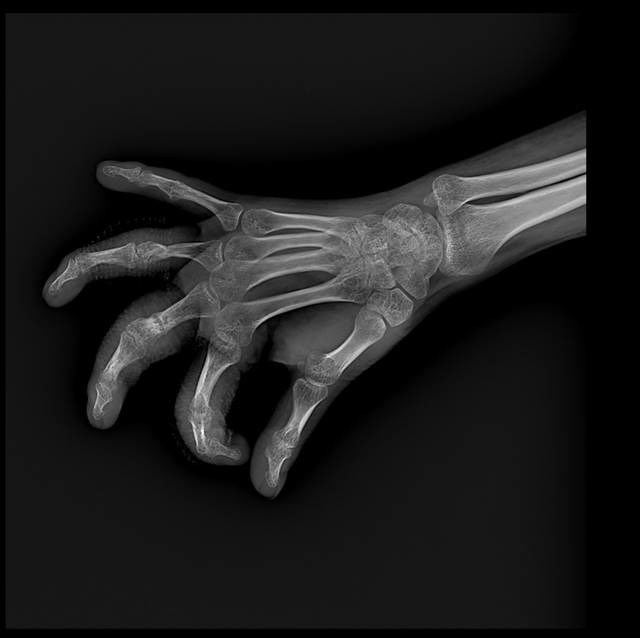 Full Body 300kHU 800mA 65kW DR X Ray Machine BTR-650B 10