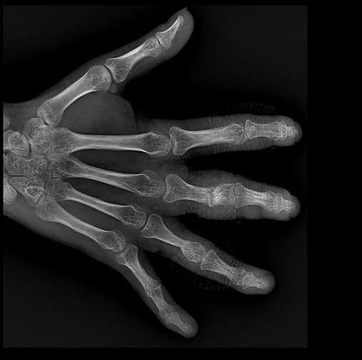 BTR-500NS Straight-Arm X-Ray 50kW 630mA Electric movement Room saving 0