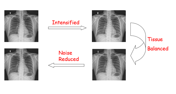 Multi-Functional 65kW FPD Remote Control Gastrointestinal Digital X Ray Machine 11