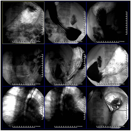 Basda Medical 62dB Dynamic Digital X Ray Machine  BTF-50 0