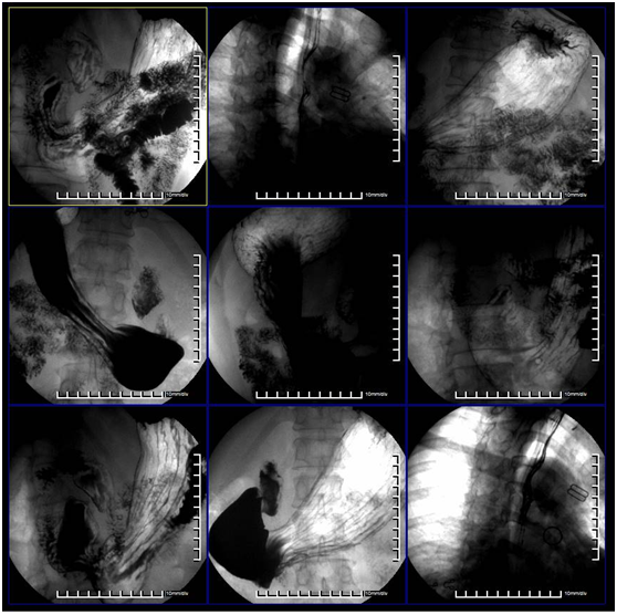 CCD DDR Detector 139um Pixel Digital X Ray Machine BTF-50 1