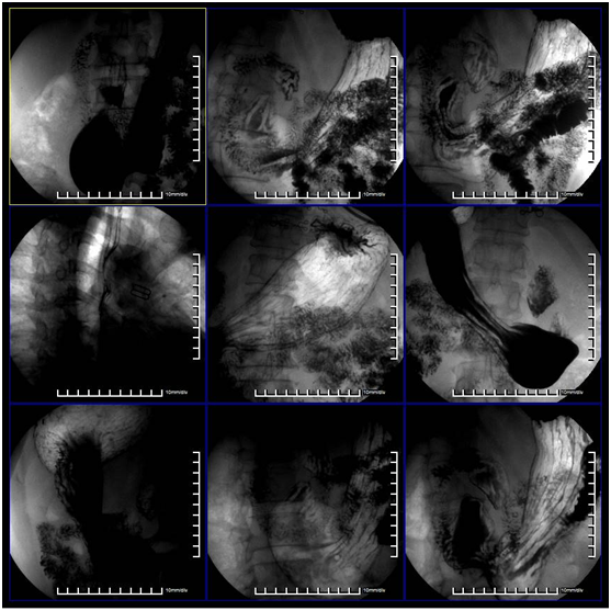 CCD DDR Detector 139um Pixel Digital X Ray Machine BTF-50 3