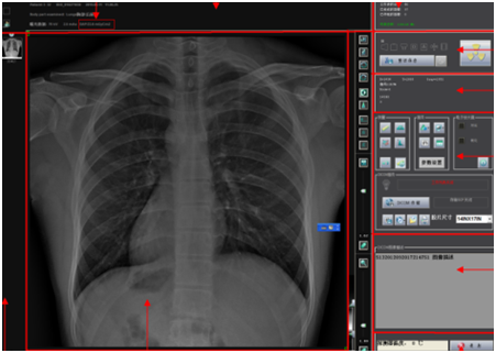 65kW DDR 1/2 FPD 800mA Floor Mounted X Ray Machine  BTR-650B 2