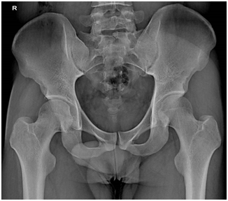 65kW DDR 1/2 FPD 800mA Floor Mounted X Ray Machine  BTR-650B 3