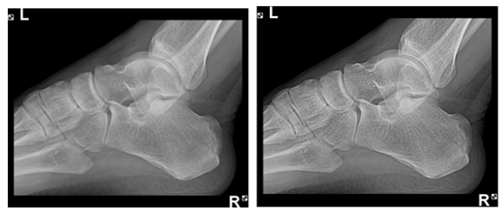 Full Body 300kHU 800mA 65kW DR X Ray Machine BTR-650B 9