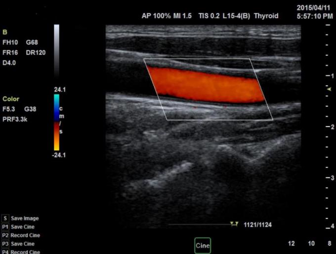 128 Array Doppler Ultrasound Device Convex Probe 3D Color BTH-50S 1