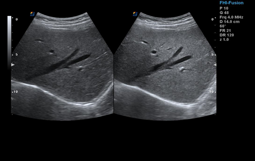 Trolley Color 3D Pregnancy Doppler Ultrasound Diagnostic System BTH-150S 0