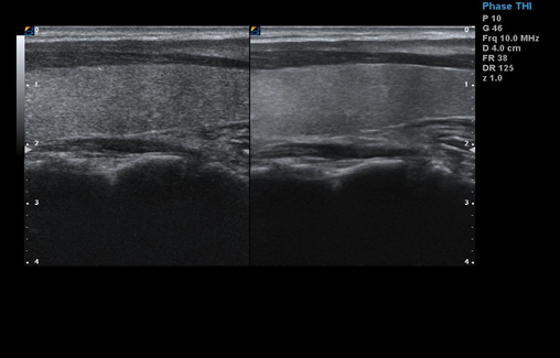 3D Ultrasound Pregnancy Cartbase Color Doppler Ultrasound Color Ultrasound Machine for Obstetrics & Gynecology BTH-150S 2