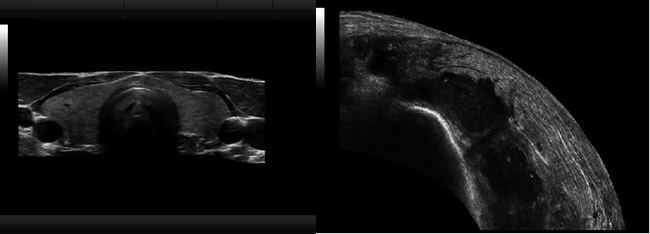 3D Ultrasound Pregnancy Cartbase Color Doppler Ultrasound Color Ultrasound Machine for Obstetrics & Gynecology BTH-150S 1