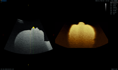 3D Pregnancy 4 Sockets 220 Volt Color 4D Ultrasound Doppler Machine BTH-300S 0