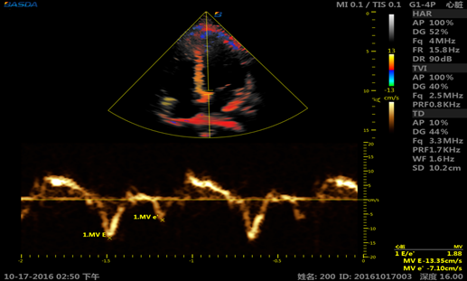3D Pregnancy 4 Sockets 220 Volt Color 4D Ultrasound Doppler Machine BTH-300S 1