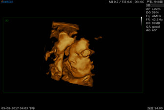 3D Pregnancy BASDA Diagnostic Ultrasound Equipment BTH-200S 1