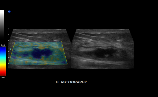 Four Sockets 4D Color 3D Pregnancy Medical Ultrasound Machine BTH-200S 0