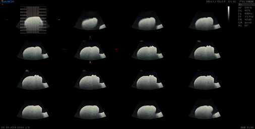 Four Sockets 4D Color 3D Pregnancy Medical Ultrasound Machine BTH-200S 1