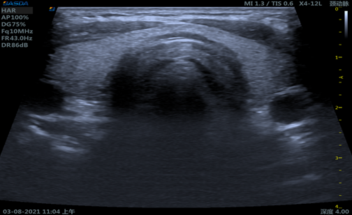 NMPA Approved Color Ultrasound BASDA Medical Ultrasound System BTH-90S 0