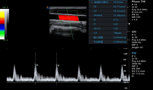 Cartbase Linear Probe 110V Medical Ultrasound Machine BTH-90S 0
