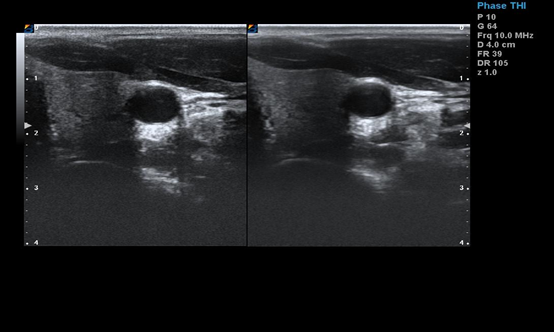 Cartbase Linear Probe 110V Medical Ultrasound Machine BTH-90S 1