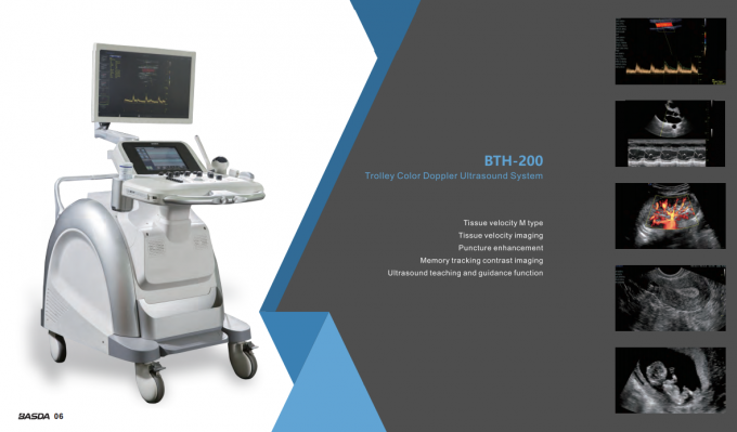 3D Pregnancy BASDA Diagnostic Ultrasound Equipment BTH-200S 2