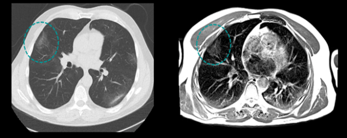 22 Square Meters Superconducting Mri Machine Dual Transmit 300 Liters Bstar-052 0