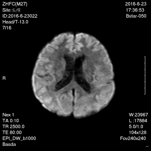 BSTAR-050 Superconducting Magnetic Resonance Imaging Open Machine 0.5T 0