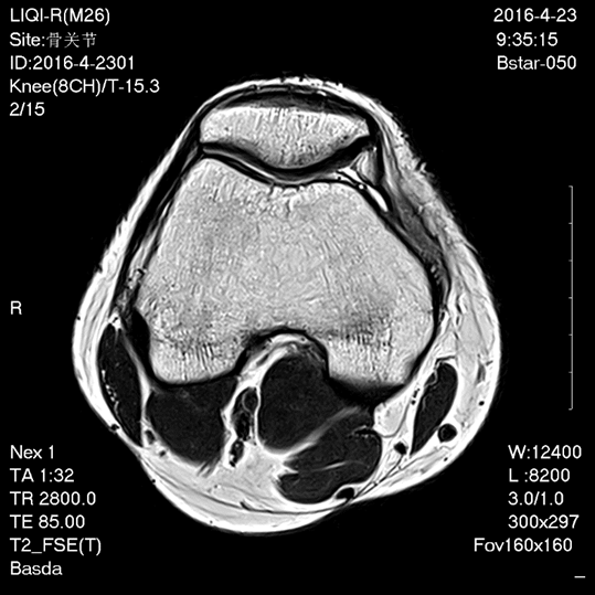 BSTAR-050 Superconducting Magnetic Resonance Imaging Open Machine 0.5T 1