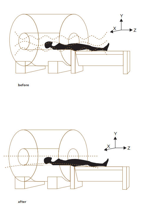 Digital Fiber 0.52 Tesla Superconducting MRI System 600mm Magnet Diameter Bstar-052 0