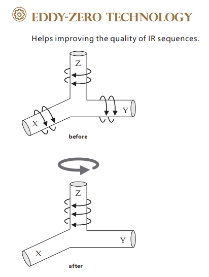One Button 0.52T Superconducting MRI Machine With Eddy Zero Technology Bstar-052 1