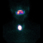 Gamma Camera Nuclear Medicine Machine Parallel Collimator 1.5mm UFOV