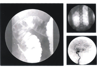 Digital Fluorioscopy System, Cost Effective, Good Images, High Resolution Monitor, 3 Fields Can Be Selected, Spot-Film
