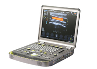 3D Color Doppler Laptop Ultrasound Scanner Triplex Synchronous Trapezoidal Imaging