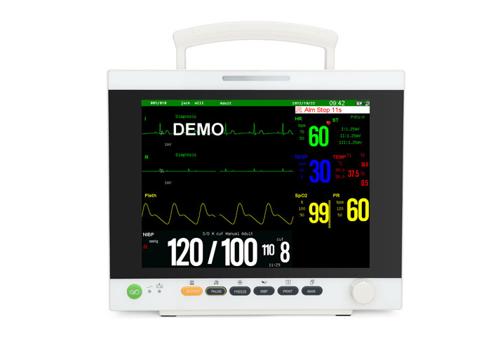 4AH Rechargeable Patient Monitoring Machine 800×600 Dpi 12.1" TFT 6 Parameter